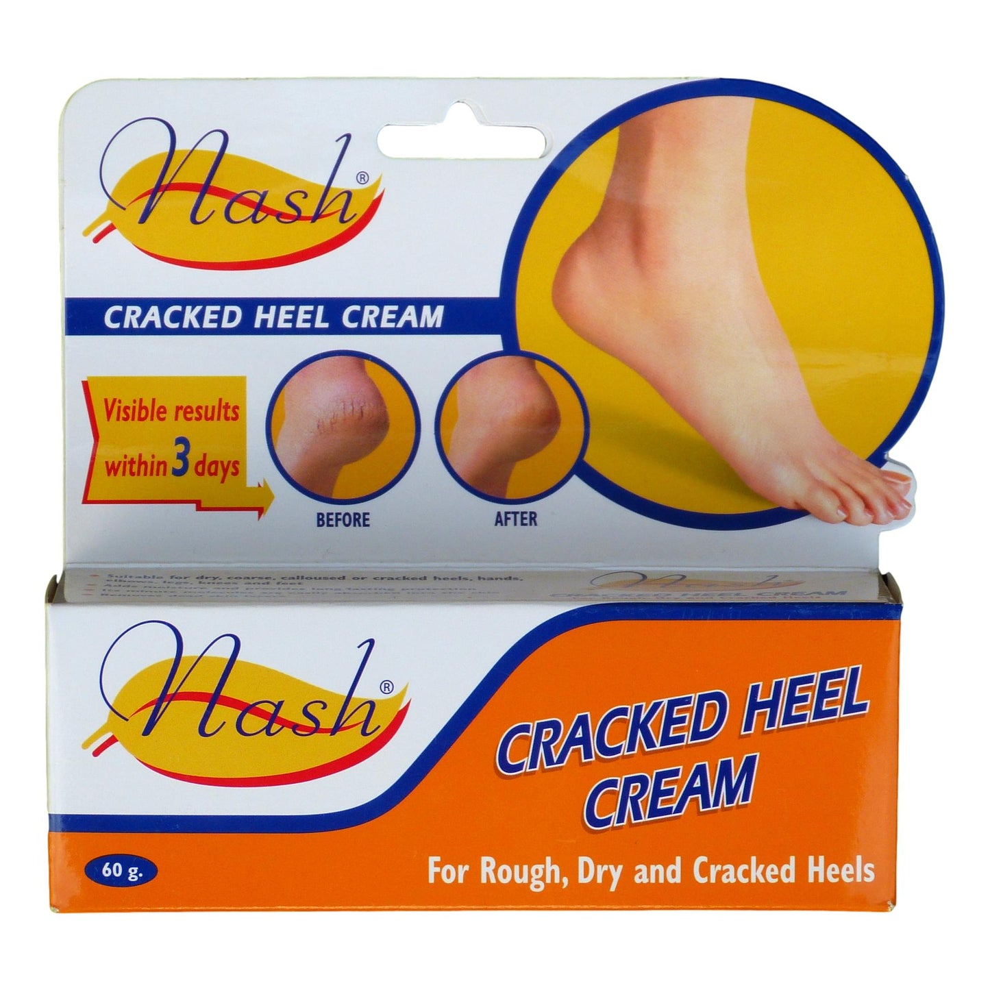 Nash Cracked Heel Cream for Rough, Dry and Cracked Heels 60g - Asian Beauty Supply